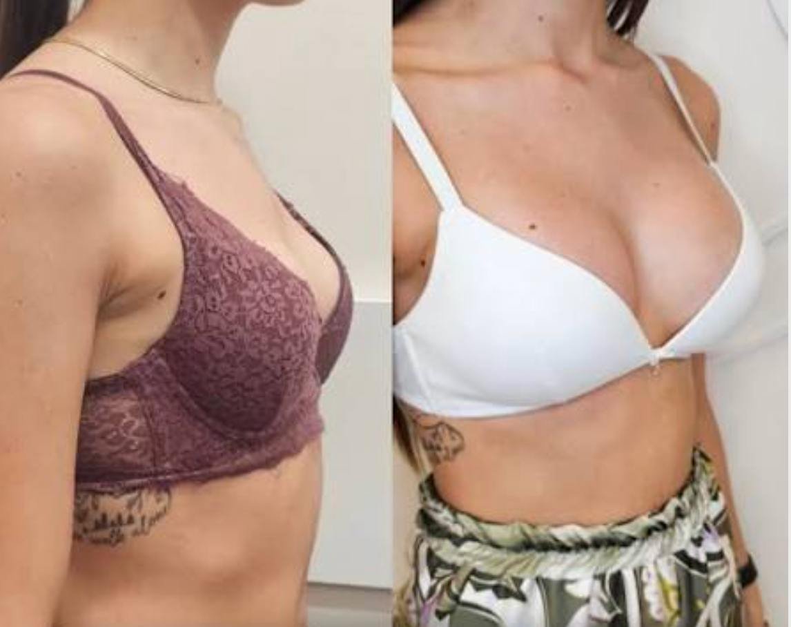 Foto opinião 2