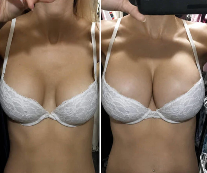 Foto opinião 1